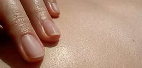 Ayurveda Marma Vital Massage